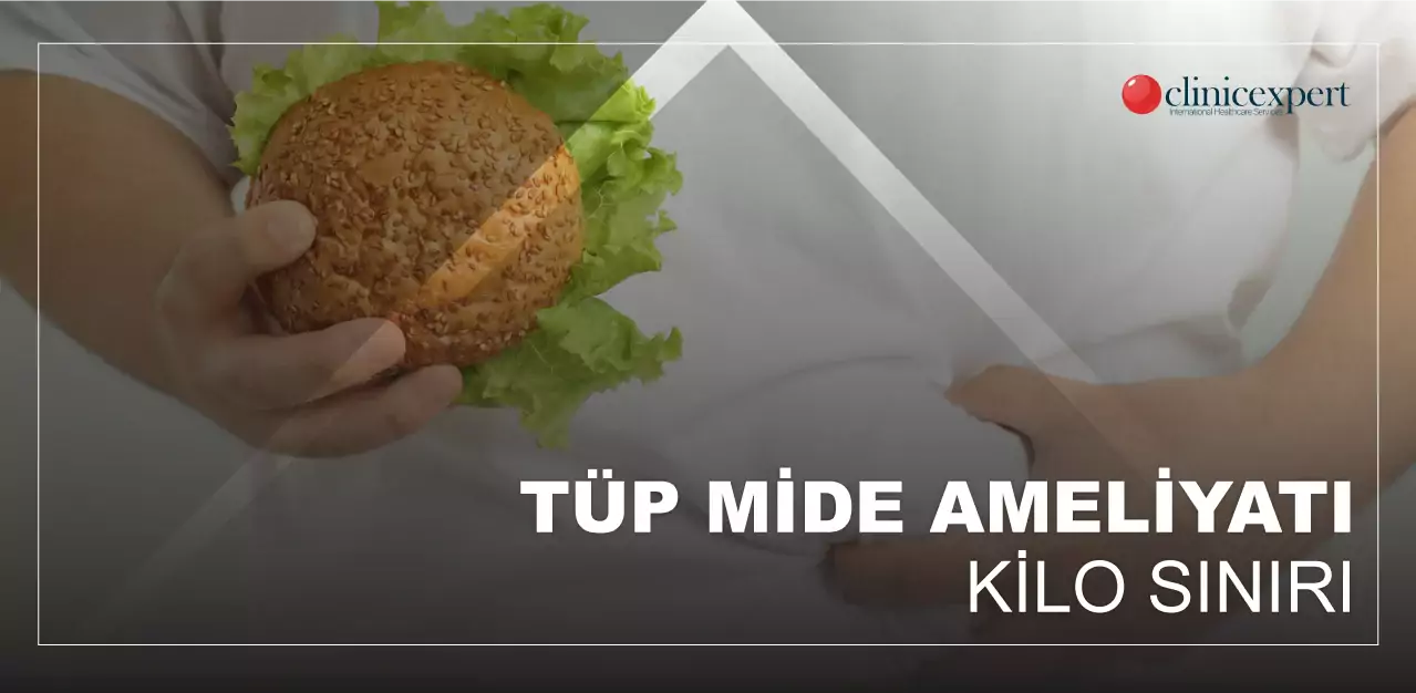 tüp-mide-ameliyatı-kaç-olanlara-yapılır