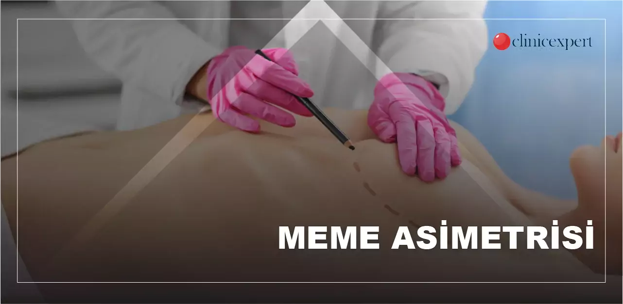 asimetrik meme nedir