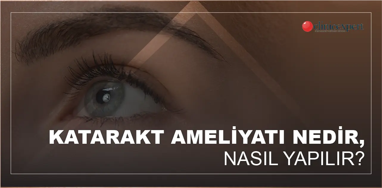 KATARAKT AMELİYATI NEDİR, NASIL YAPILIR